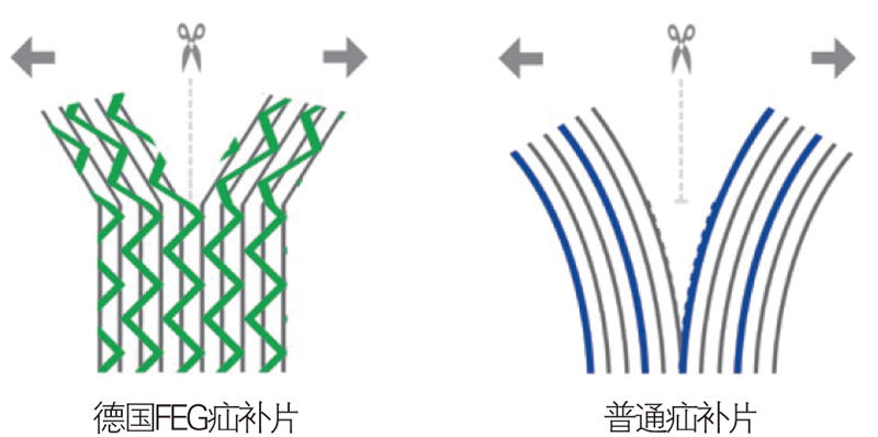 德國PVDF材質疝氣補片-IPST
